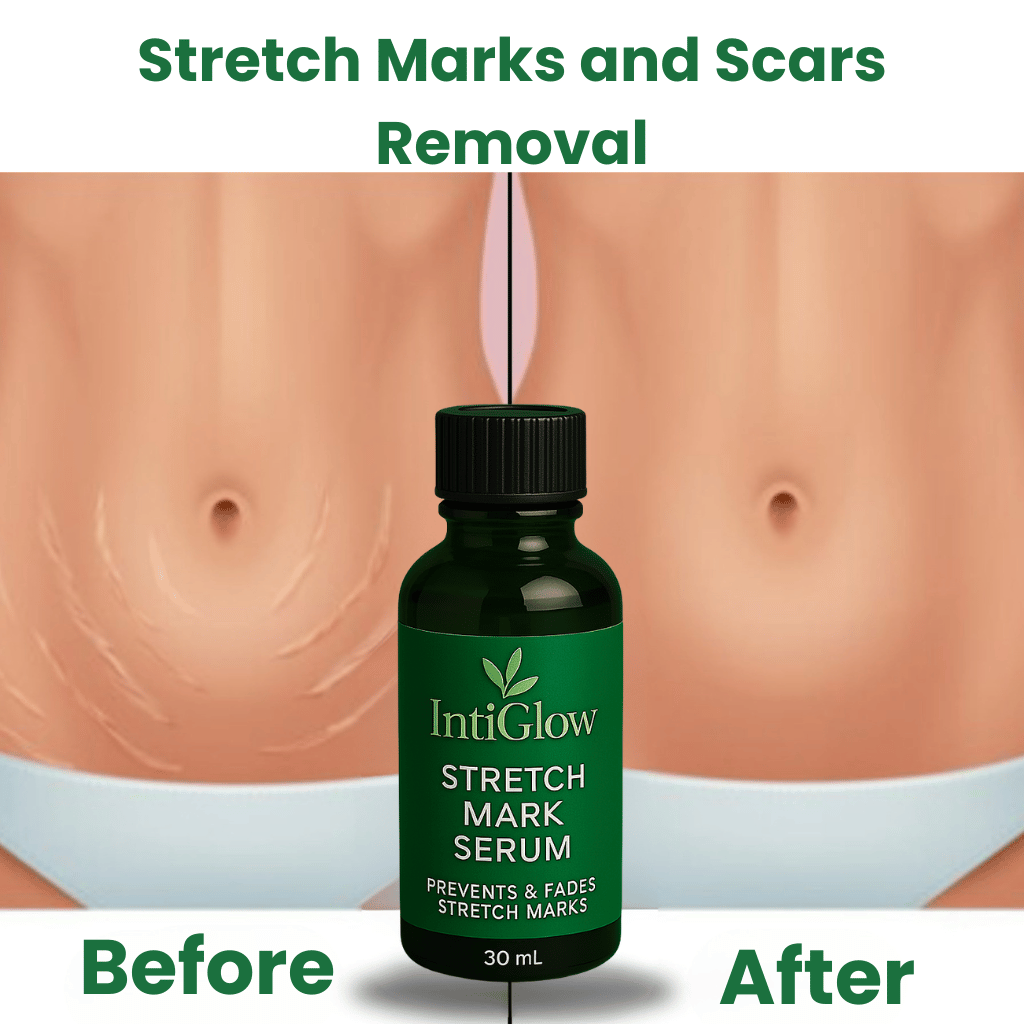 Stretch Marks and Scars Removal Cream for Pregnancy